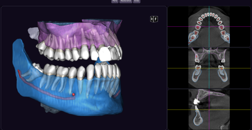 Tomografia zębów CBCT Pszczyna